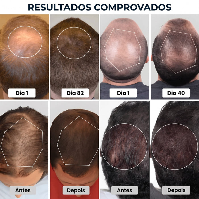 Boné LED para Crescimento Capilar 2